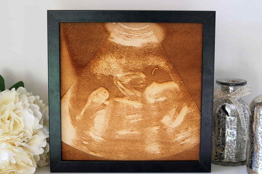 Baby Scan Engraving - Engraved into Wood - Framed Baby Scan